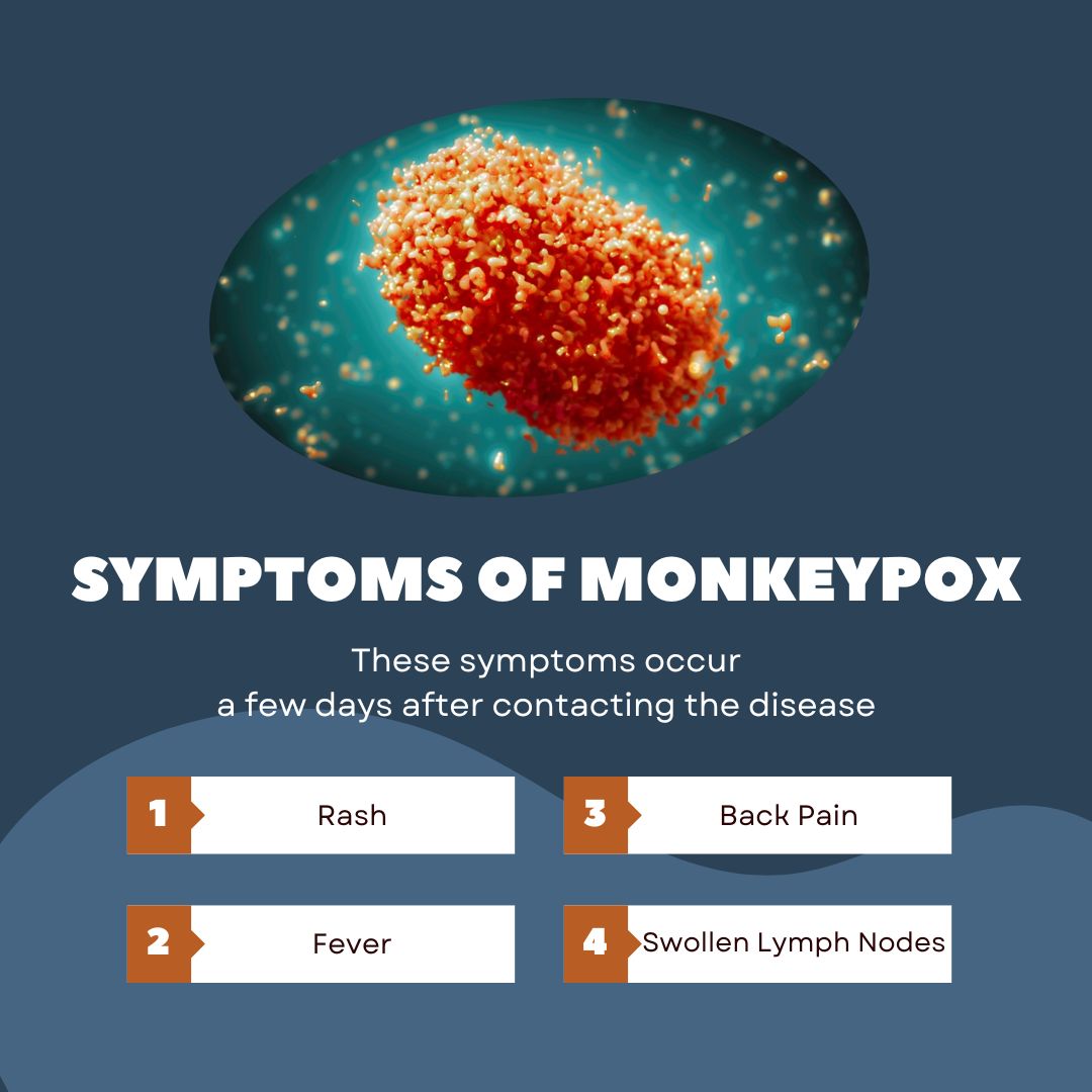 Monkeypox spreads through close, personal, skin to skin contact with people who have monkeypox rashes or sores. Graphic by: Isabel Andrade
